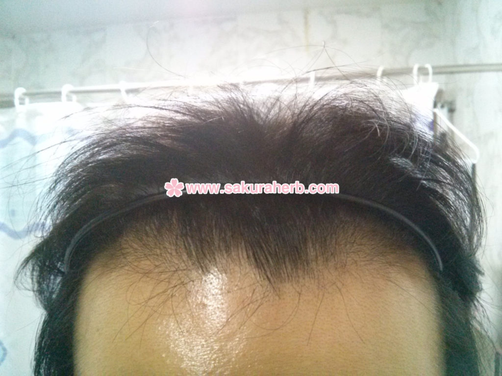 ${review_item.post_title}