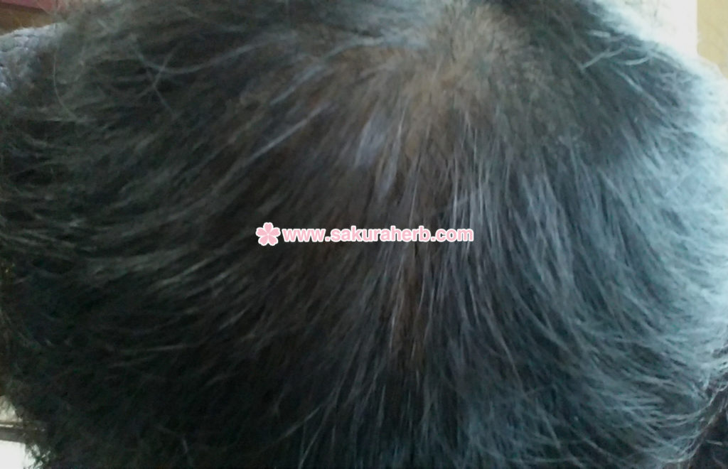 ${review_item.post_title}